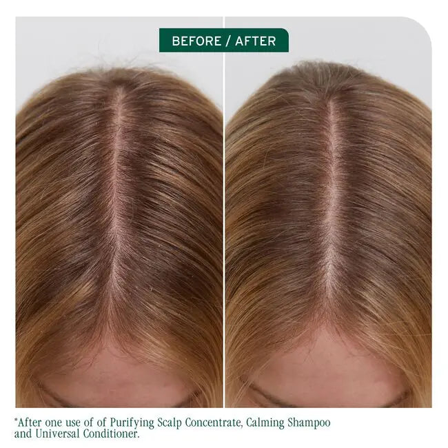 Before and after comparison of hair condition on a person's head with text indicating product use.