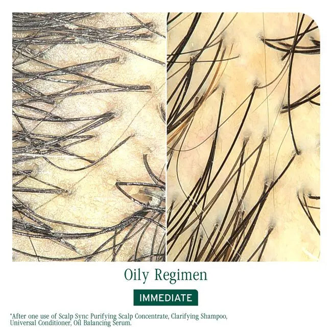 Close-up of hair strands with text indicating 'Oily Regimen' and 'Immediate' treatment.