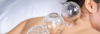 Person receiving cupping therapy with glass cups on a blurred background