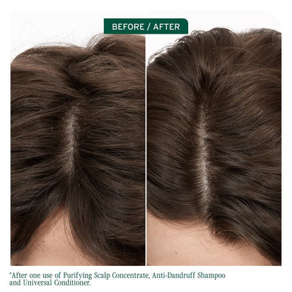 Before and after comparison of scalp and hair with text indicating product use.